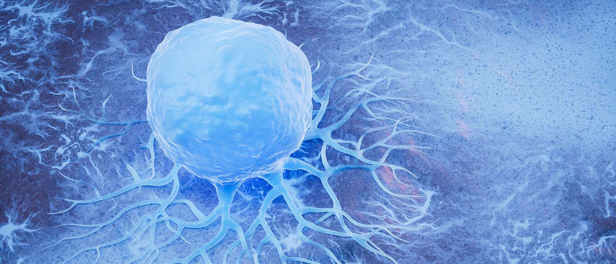 Immunotherapy has emerged as a new treatment for head and neck squamous cell carcinoma, but getting the immune system to attack certain tumors has been difficult. New discoveries made by MCW’s Dr. Joseph Zenga and his team could change that. Learn more: mcw.edu/mcwknowledge/m…