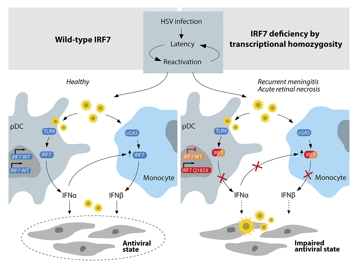 JExpMed's tweet image. Werner, Mogensen et al. @AarhusUni identify genetically heterozygous and transcriptionally homozygous deficiency of IRF7 as an inborn error of interferon immunity underlying #herpesvirus CNS infection. hubs.la/Q03QLz--0

#HumanDiseaseGenetics #Immunodeficiency