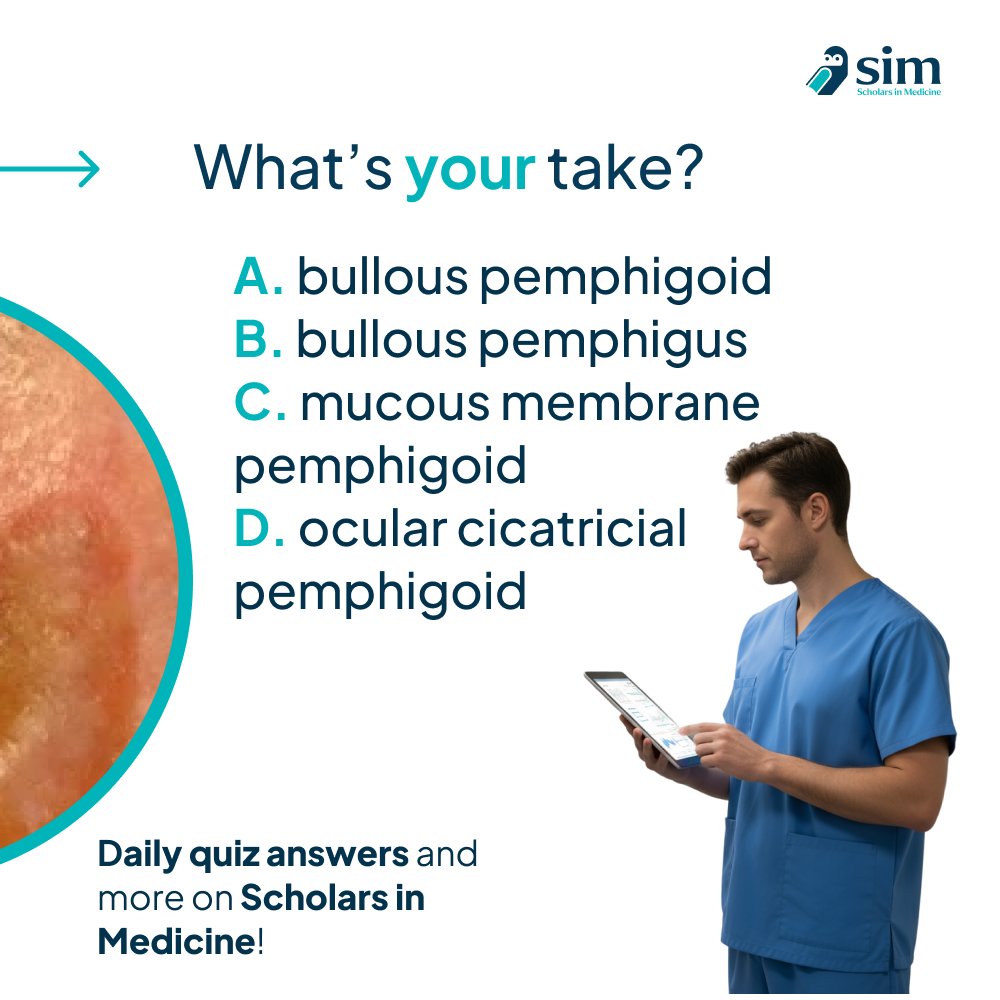 scholarsinmed_'s tweet image. 💡 Derm Quiz:
Which condition has a strong link to internal malignancy?
A️ Bullous pemphigoid
B️ Bullous pemphigus
C️ Mucous membrane pemphigoid
D️ Ocular cicatricial pemphigoid

Answer here:
👉 scholarsinmedicine.com/dashboard?quiz…

#Dermatology  #MedicalEducation #Pemphigus #MedTwitter