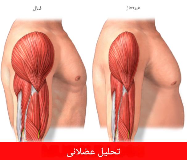 بعد از ۳۰ سالگی، مردها هر دهه تا ۵ درصد از عضلاتشون رو از دست میدن.

تا ۶۰ سالگی، بیشترشون بدون درد نمی‌تونن از پله بالا برن.

بدتر از این؟

از دست دادن عضله مهم‌ترین عامل پیش‌بینی مرگ زودهنگامه.

اینجا ۹ روش علمی برای بازسازی عضلات به طور طبیعی آوردم 

(بدون نیاز به استروئید):