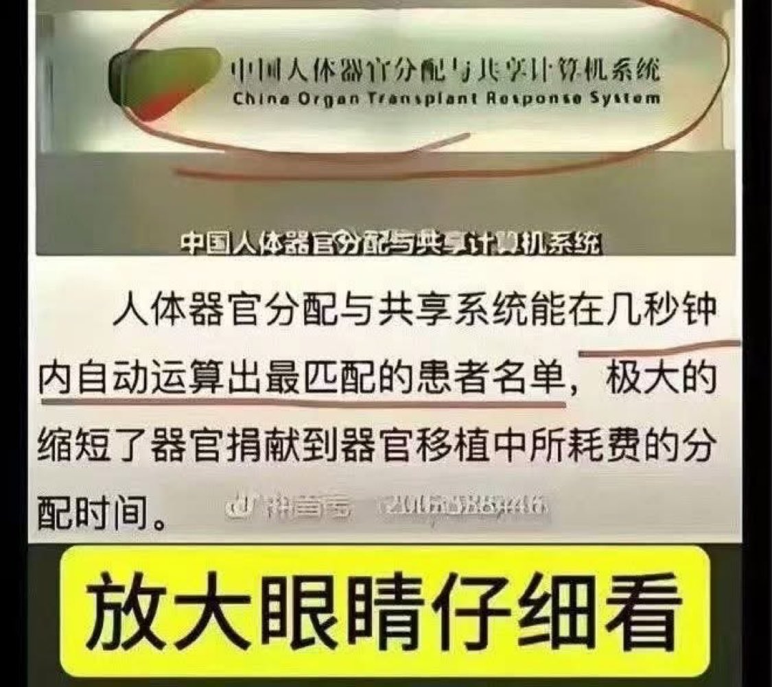 Screenshot of the Chinese Human Organ Allocation and Sharing System interface in English and Chinese, displaying title Chine Organ Transplant Response System, text about citizens voluntary donation rights protected by law with informed consent, no coercion allowed, dated September 1 2015, and yellow highlighted section noting large-scale application software development.