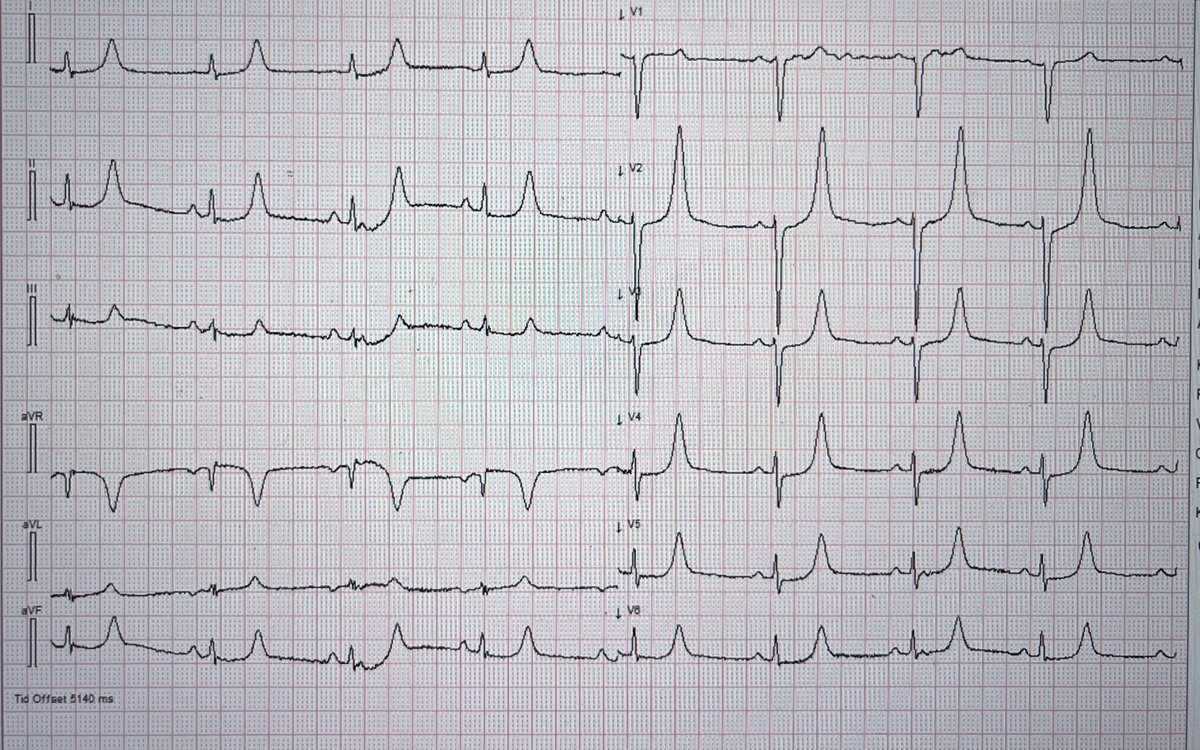 Elderly female found with GCS 8.