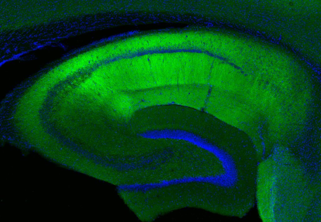 The most detailed molecular map of the hippocampus has arrived! @MPIbrain researchers combined RNA &amp; protein data to map 27,000+ molecules at super-high resolution, revealing new learning &amp; memory findings in mice: bit.ly/3WgAaui