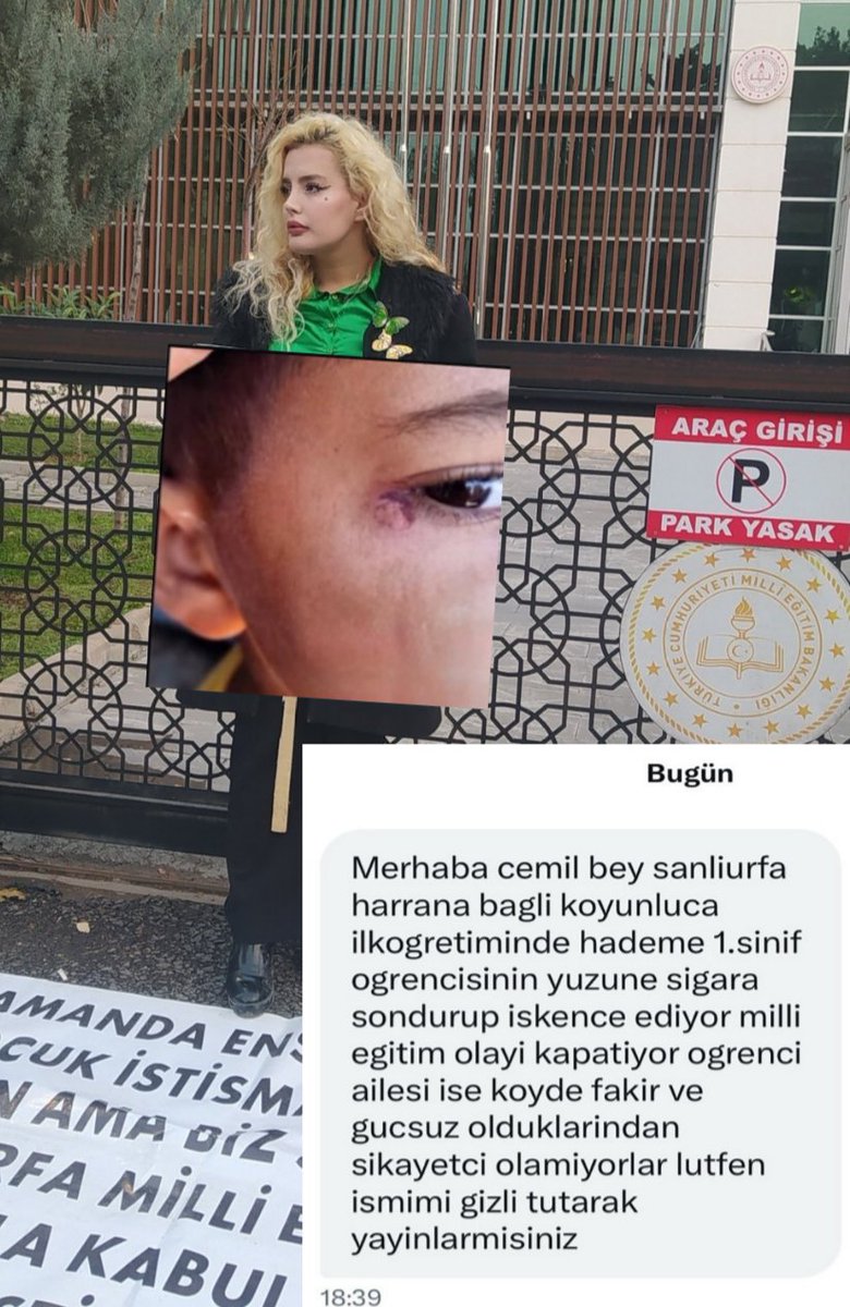 Bugün çocuklarımız için yaptığım eylemin 690. Günüydü.
Harranda bir okulda  çocuğun hademe tarafından İŞKENCE GÖRÜP YÜZÜNDE SİGARA SÖNDÜRDÜĞÜ ve İL MİLLİ EĞİTİM MÜDÜRLÜĞÜNÜN olayı kapattığı iddiası var.
Çocuğun ailesi yoksul olduğu için cesaret edip şikayet edemediği söyleniyor.