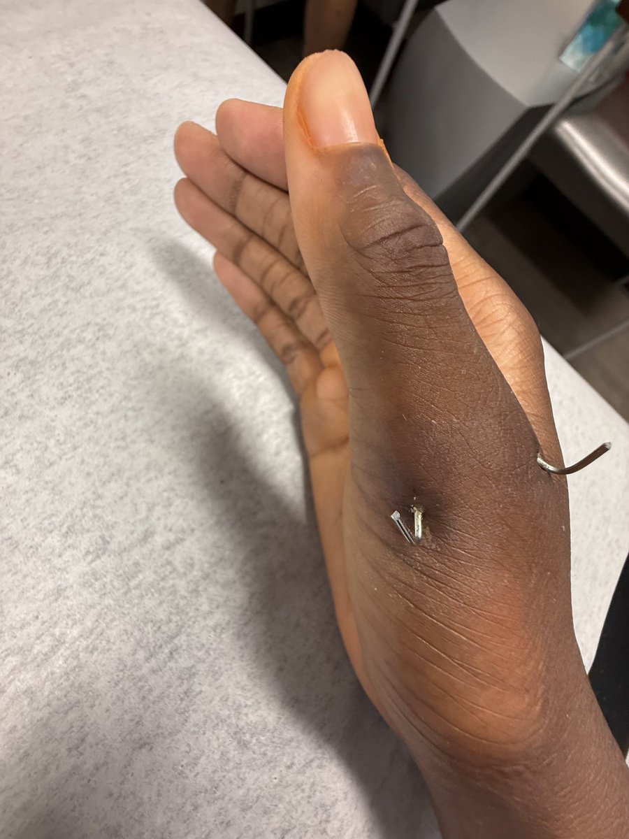 Pins out in 2 weeks, just in time for the playoffs. <a href="/ScottRapp17/">Scott Rapp</a> <a href="/Marchen44/">On Da Marc Sports🏈</a> <a href="/__DaGuru/">RICH</a> <a href="/Coach_DeLay/">Laban DeLay</a> <a href="/COACHMAC515/">Jeff Macdonald</a> <a href="/JButler_210/">Josh Butler</a> <a href="/CSAPrepStar/">PREPSTAR</a> <a href="/BallCoachHP/">Recruiting 1-0-1</a> <a href="/FCRecruits/">First Choice Recruiting</a> <a href="/TXTopTalent/">TX TOP TALENT</a> <a href="/widereceivermag/">Wide Receiver Magazine</a> <a href="/AndrewLee_CFB/">Andrew Lee</a> <a href="/Coach_Mitch2/">Semaj Mitchell</a> <a href="/iwp4short/">Wesley Harwell 🦅</a> <a href="/TrustMyEyesO/">⭕️FFERTUNITY</a>