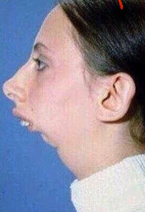 How Nicky “on pace for 127” Schmaltz’s chin has been tucked this year. <a href="/J_Swish24/">Jordan Schmaltz</a>