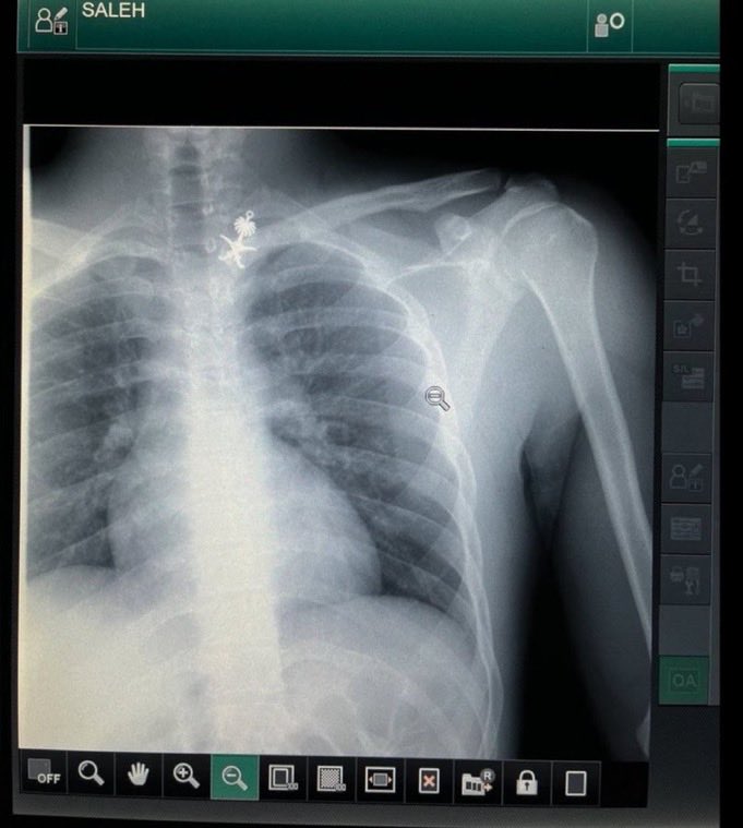 نحن جزء من رؤية 2030، فلماذا نُترك بلا عمل في تخصصنا الذي هو عيون الطب وعين الوطن؟
#عطاله_تخصص_الاشعه_الصحه_القابضه #الصحه_القابضه
<a href="/SaudiMOH/">وزارة الصحة السعودية</a>  <a href="/FahadAlJalajel/">فهد الجلاجل</a>