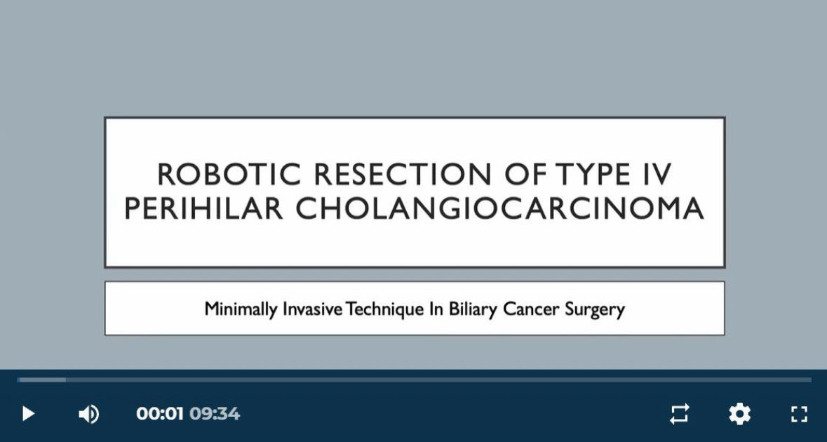 IswantoSucandy's tweet photo. Sharing our robotic surgery technique for Type IV perihilar cholangiocarcinoma. This is the most complex hepatobiliary resection undertaken via robotic surgery at this time. Refer to our paper on the Annals of Surgical Oncology:

https://t.co/qTFj8fHNWx

https://t.co/R28LhW9Zmn https://t.co/JIfHN7VR3x