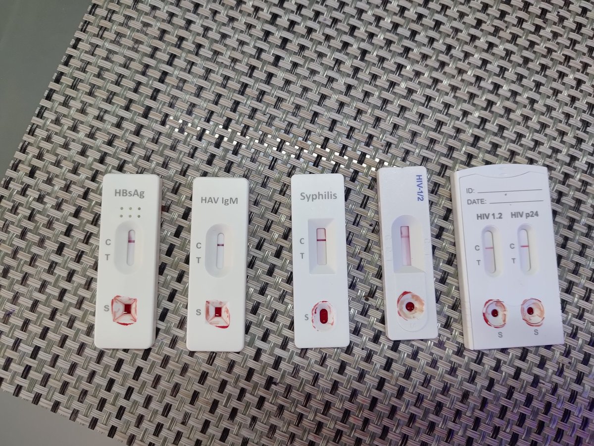 Vivir el ambiente liberal, también significa ser responsable,  como cada 6 meses me vuelvo a hacer pruebas. Juega protegido,  juega seguro.