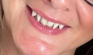 bashaw_phil's tweet image. Would you date a girl with a true carnivore mouth?