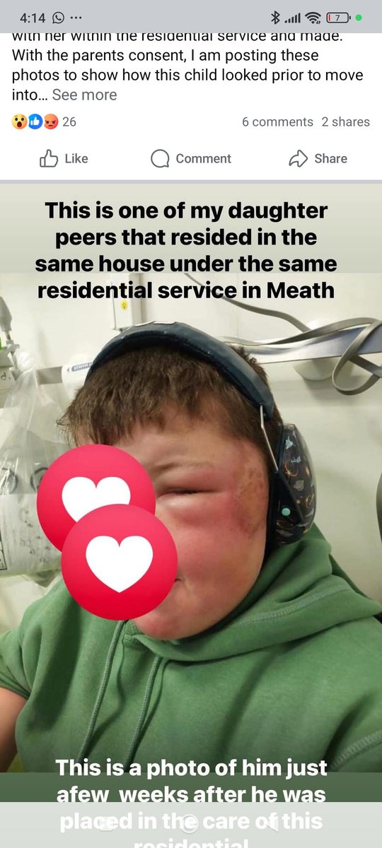 Cailìn-deas 🇮🇪💚 tweet media