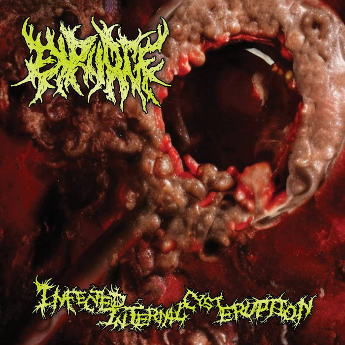 ZTextremeMetal's tweet photo. #NowPlaying
-Expurge
-Infected Internal Cyst Eruption
-2025
-Slamming Brutal Death Metal
https://t.co/eHWD5jNrGZ
#SlammingBrutalDeathMetal ๐ฆ๐บ #RIFFS
#SLAM #GUTTURAL #vocals #guitar
#bass #drums #BlastBeats #artwork
#PathologicallyExplicit #logo #groove
#GoreDeath ๐ค๐ป๐ฅ๐ค๐ป https://t.co/knvHv4bTbQ