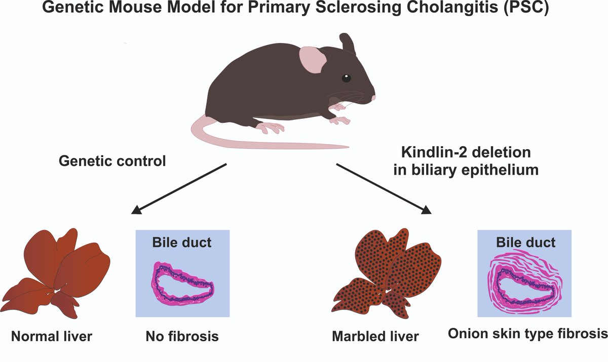 MetabolismAnd's tweet image. 🧬 New animal model reveals a “onion-skin” type of periductular fibrosis after deletion of biliary tight-junction adapter kindlin-2, mirroring key features of Primary Sclerosing Cholangitis (PSC). 

🔗oaepublish.com/articles/mtod.…

#PSC #LiverFibrosis #TightJunctions #Kindlin2