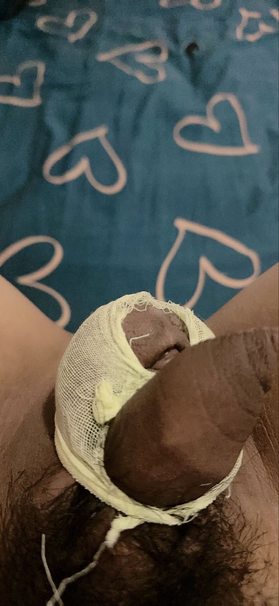 白白小疯狗 tweet media