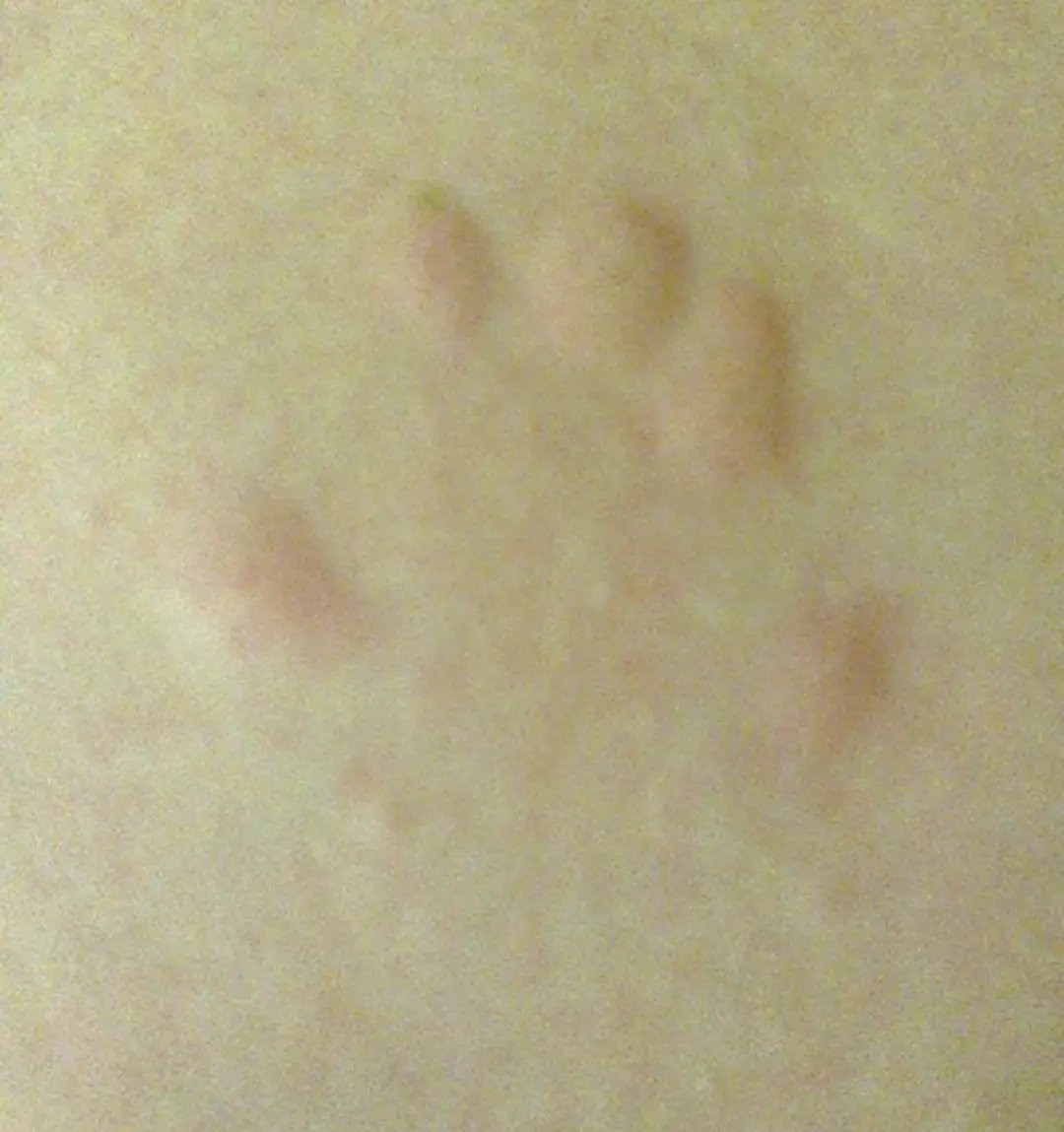 Throwback to when I discovered I was *really* allergic to cats...