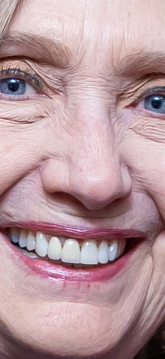 Do you think her teeth are real?