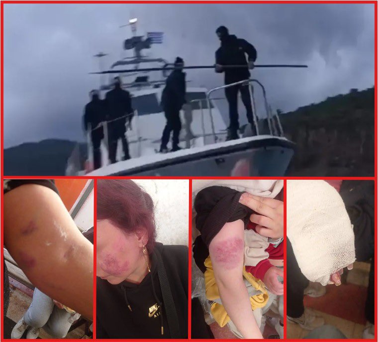 ABoatReport's tweet photo. Brutally Beaten Under Greek Pushback

A boat carrying 34 people, 11 of them small children, was intercepted inside Greek waters near Chios on October 25.

Masked men from a Greek Coast Guard vessel threatened the group at gunpoint, beat them, seized their phones and belongings, and towed their boat back toward Turkey.

A young girl hid her phone and called Aegean Boat Report for help. We alerted Turkish authorities and stayed in contact until rescue arrived. Videos showed clear evidence of violence – a man bleeding from his head, a woman from her hand.

For more than five years, Greek authorities have systematically beaten, tortured and abandoned people at sea – crimes confirmed by Frontex and OLAF investigations. Europe cannot claim to defend human rights while financing and protecting those who violate them.

All 34 were Hazara from Afghanistan – a minority the Taliban targets for persecution. When deported from Turkey through Iran to Afghanistan, they face imprisonment or death.

📍 Full story on https://t.co/ZyvIhfvRuv

#AegeanBoatReport #Pushbacks #Greece #EU #Refugees #HumanRights #Hazara #Afghanistan #BorderViolence