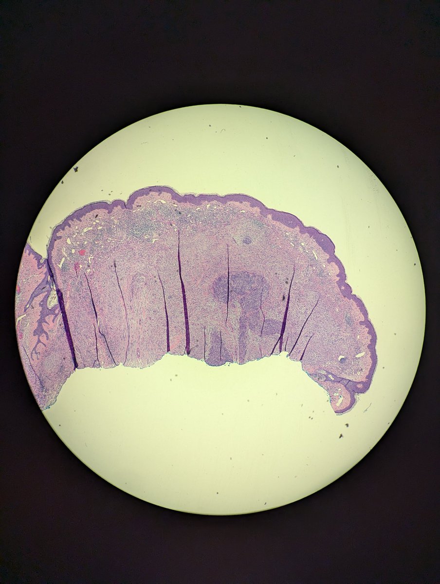 Avi Bitterman, MD tweet media