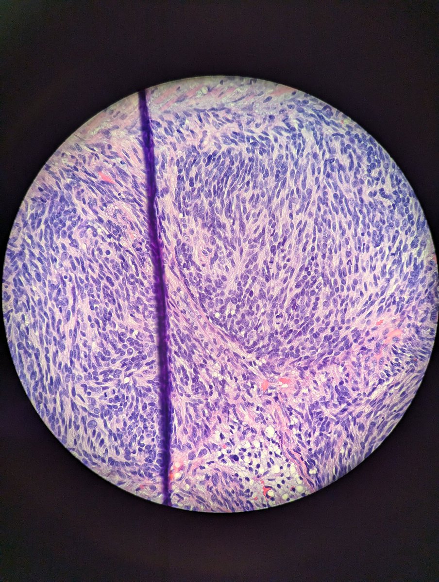 Avi Bitterman, MD tweet media