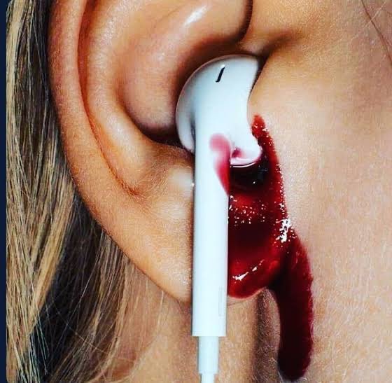 भारतीय प्रधानमंत्री नरेंद्र मोदी जी का भाषण सुनने के बाद बिहार की जनता की कान का हालत खराब हो गया है। 

अब लोग अपने कान का इलाज करवाने के लिए दूर-दूर हो और अस्पताल में भाग रहे हैं।

 क्या आपने मोदी जी का भाषण सुना बिहार वाला???