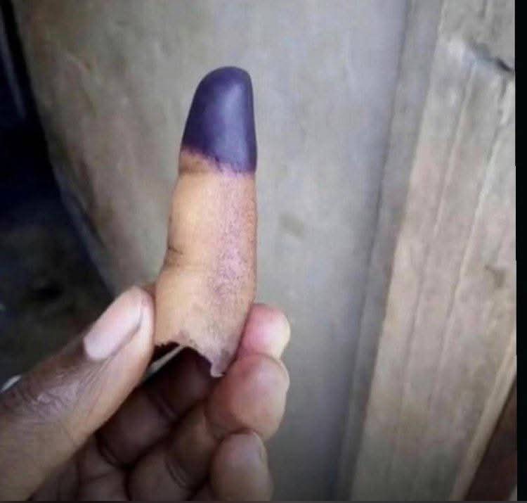 Genz kidole yako kama iko hivi ,wanahepa nayo..