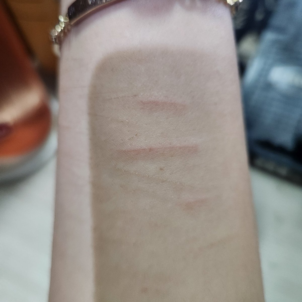 bowtiesandbats's tweet photo. Cut myself again at school, lowk wish I could go deeper (with the fear of cutting too deep, getting the wound infected and now having anything sharp enough) #shtwt #shedtwt #swlfharm https://t.co/w8qubPZ32B