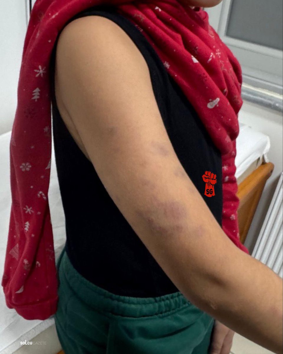 SKANDAL | İstanbul Bayrampaşa Ali Ülker Ortaokulu'nda otizmli 5. sınıf öğrencisi bir çocuk, okulda cinsel istismara maruz kalıp darp edildi.

Darp raporu alan aile, şiddet sonucu testislerinde dış müdahaleye bağlı kanama oluştuğunu söyledi.

Okul idaresinin "Kendi yapmıştır"