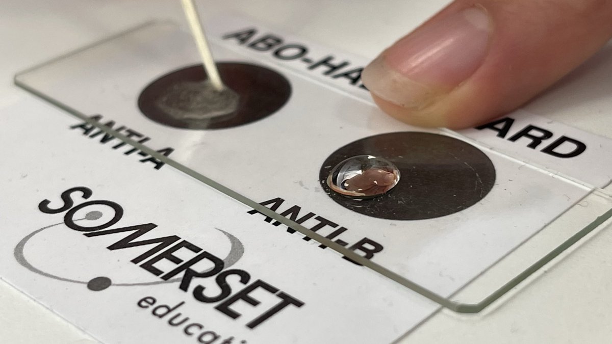 🔬📈 El BIE sigue y mejora: de la promoción 2024/25 a la 2025/26: grupos sanguíneos (🩸) e investigación de hongos (🍄).
#BIE #BIE1 #iniciaciónalainvestigación #grupossanguíneos #hongos #somosBIEsomosCiencia #ieslossauces #benavente #unileon <a href="/sauces49000391/">IES LOS SAUCES</a> <a href="/unileon/">Universidad de León</a>