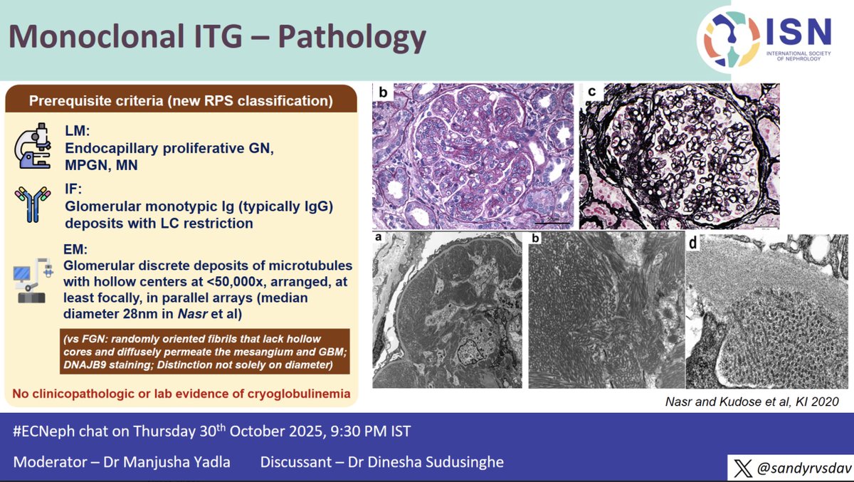 26/n #ECNeph <a href="/DineshaSNep/">Dinesha Sudusinghe</a> <a href="/myadla/">manjusha yadla</a> <a href="/ISNkidneycare/">Int Society of Nephrology</a> <a href="/Sandyrvsdav/">Sandhya Suresh</a> 
HPE of monoclonal ITG