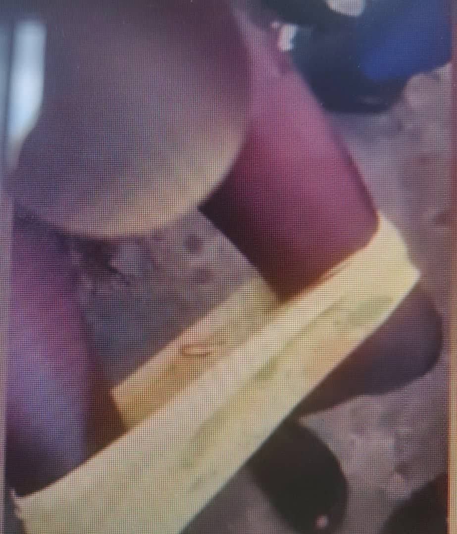 _GhChronicles's tweet photo. A seven-year-old girl in critical condition in Accra, Ghana, is recovering after her guardian allegedly punished her for bedwetting by pressing a hot spoon against her private parts, upper thighs, and buttocks.

The matter was reported at the Kotobabi Police Station which led to the arrest of the alleged perpetrator identified only as Aisha.