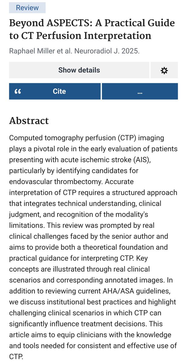 🧠 New publication from @MaimonidesRad!
“Beyond ASPECTS: A Practical Guide to CT Perfusion Interpretation”
by Miller et al., Neuroradiol J., 2025.
PMID 41159284 | DOI 10.1177/19714009251387297
#Neuroradiology #StrokeImaging #CTPerfusion