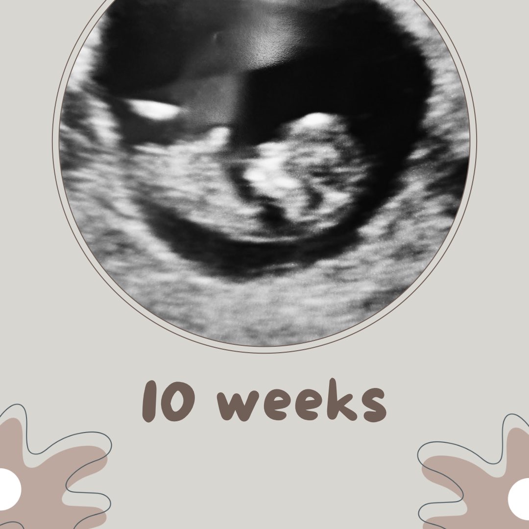 SurroPartners's tweet photo. Always a sight to be seen. Thanks GC Keisha for all that you’re doing to have that baby thrive! 🫶🏻 #surrogacy https://t.co/NTa8QZKXdu