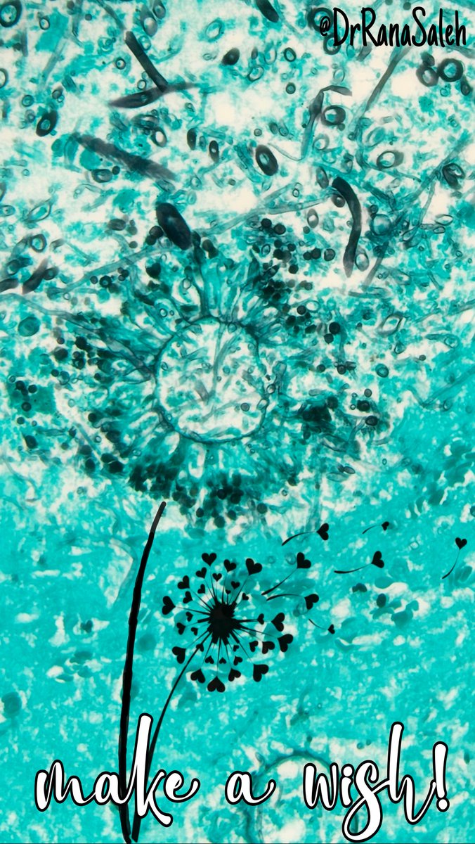 DrRanasaleh's tweet image. Hundred weeds or thousand wishes!
#aspergillus #pathart #pathbugs