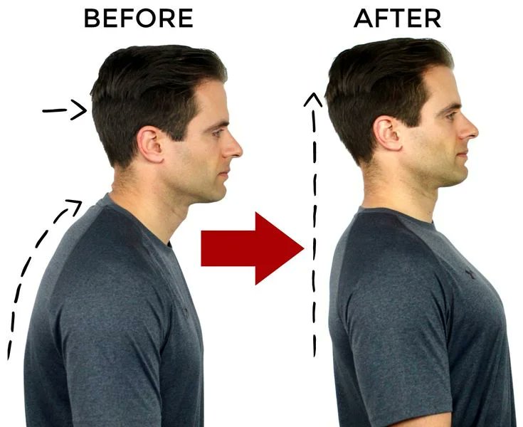 chirowestomaha's tweet photo. Natural Headache Relief by Best Omaha Chiropractor https://t.co/0Jd7pCPpys