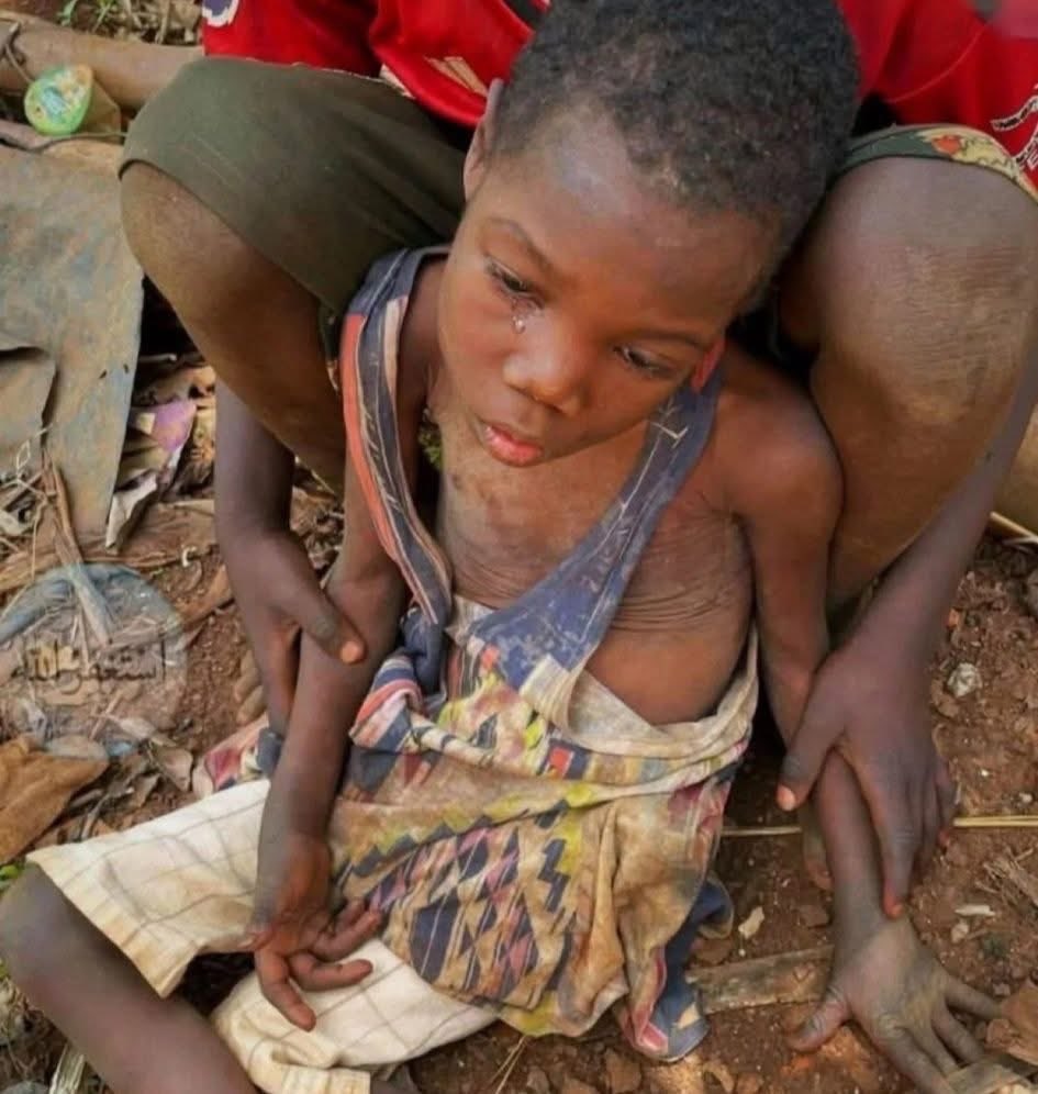 Dünya hareketlenmeye başladı, sesiniz duyulmaya başlandı, Sudan'daki kardeşlerinizden bahsetmeyi bırakmayın, çünkü onlar size en çok ihtiyaç duyanlar.!!

#Sudan_War_Updates