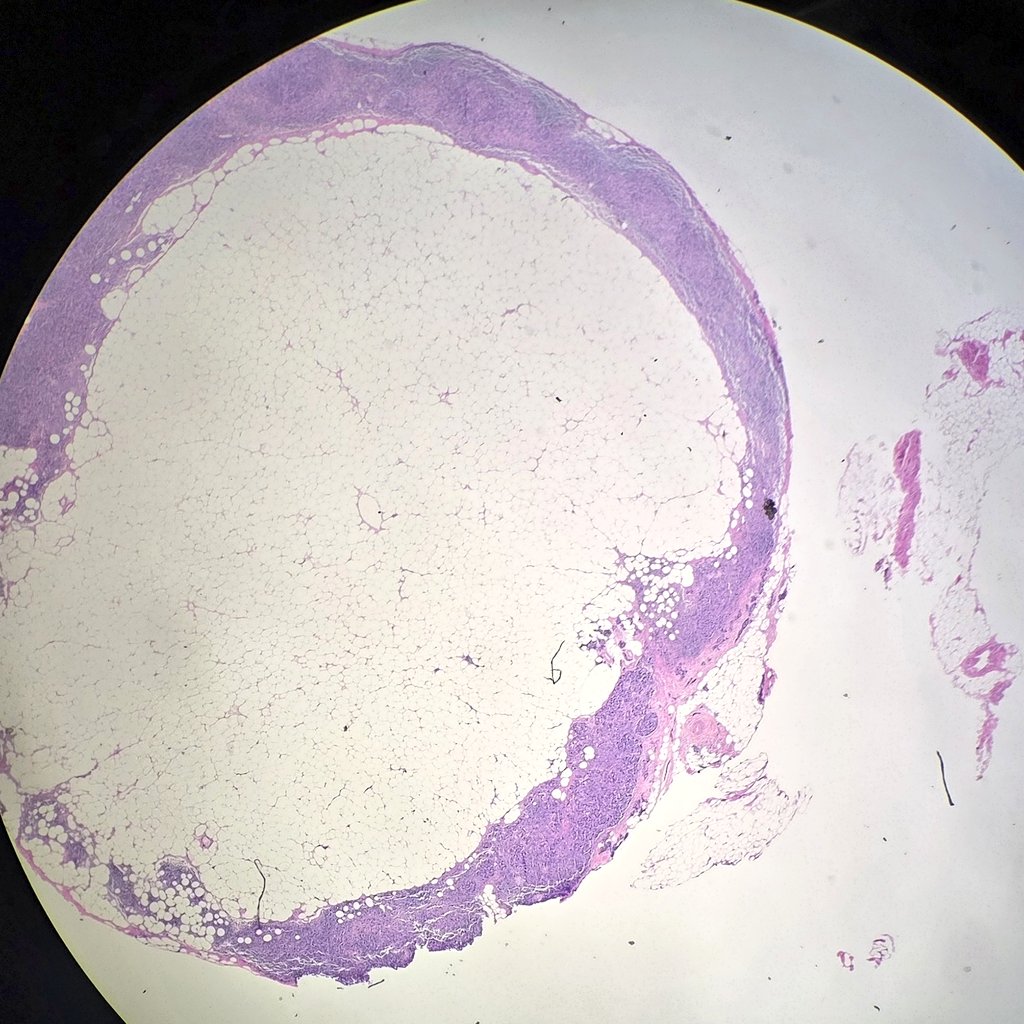 Jaclyn Rudzinski, MD tweet media