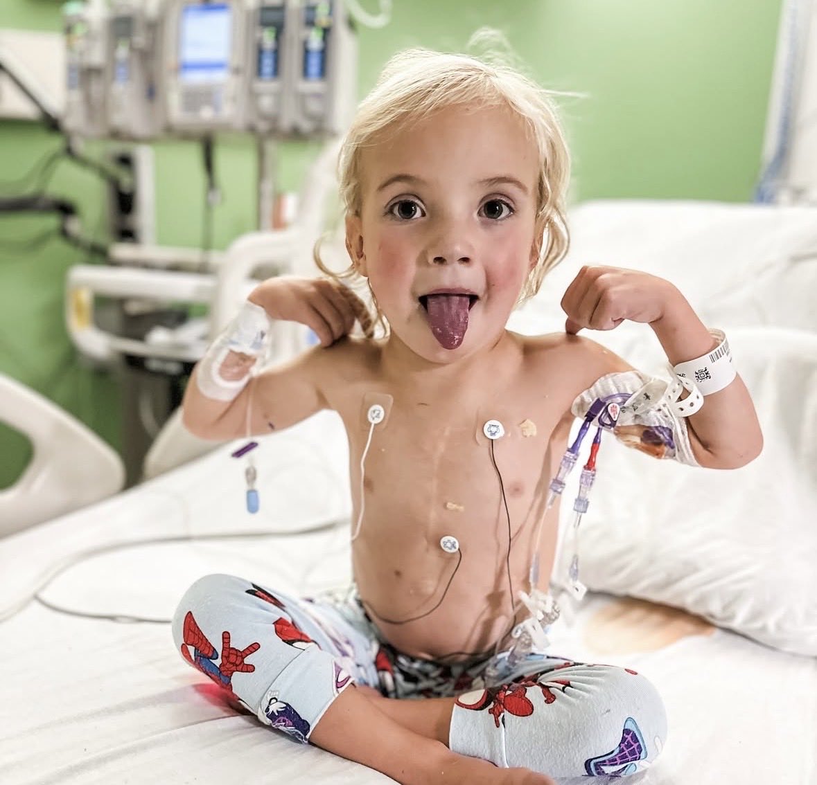 💙 Meet Boone — A 4-year-old heart warrior.

Boone was born with HLHS, a rare condition where he only has half a heart. He’s already powered through two open-heart surgeries, and now he’s waiting for the biggest one of all — a heart transplant.

While he waits at Primary