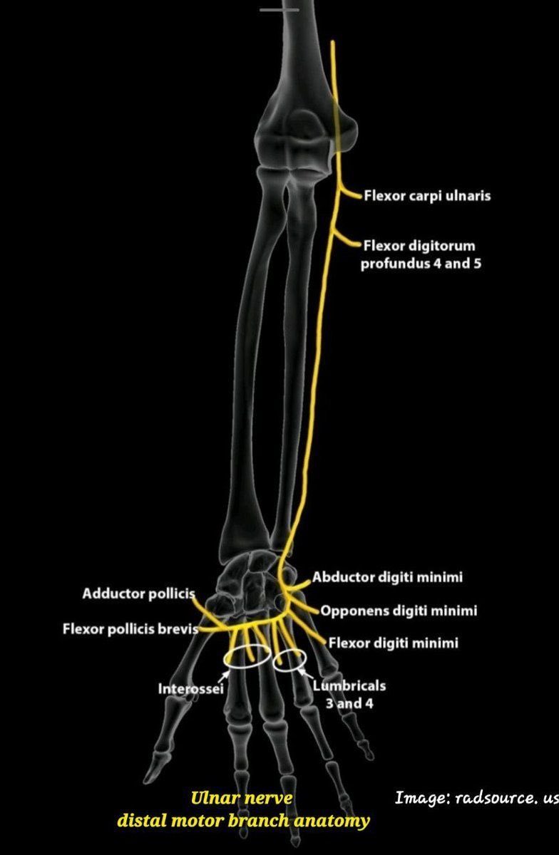 Ulnar nerve distal motor branches beautifully illustrated