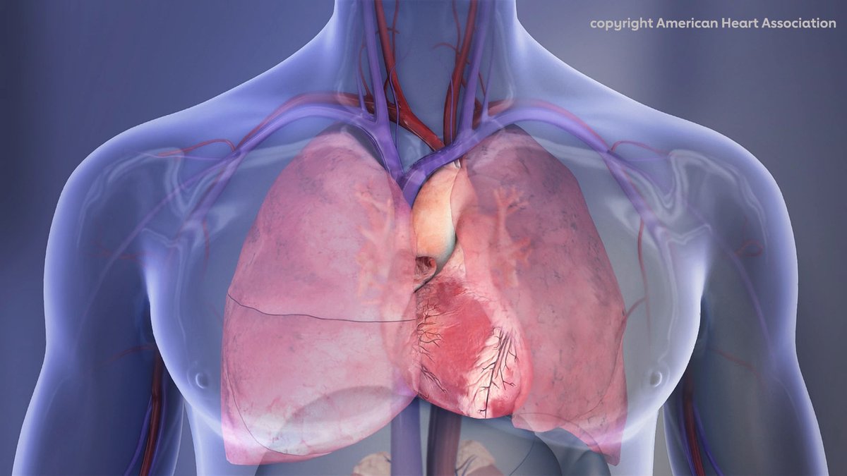HeartNews's tweet photo. Pulmonary embolism sends 500K+ people to U.S. hospitals each year and kills 1 in 5 high-risk patients. To close care gaps, @American_Heart has launched a quality initiative to advance diagnosis, treatment & follow-up care. Learn more: https://t.co/JgkXu7ukzH #PEAwareness #HeartHealth