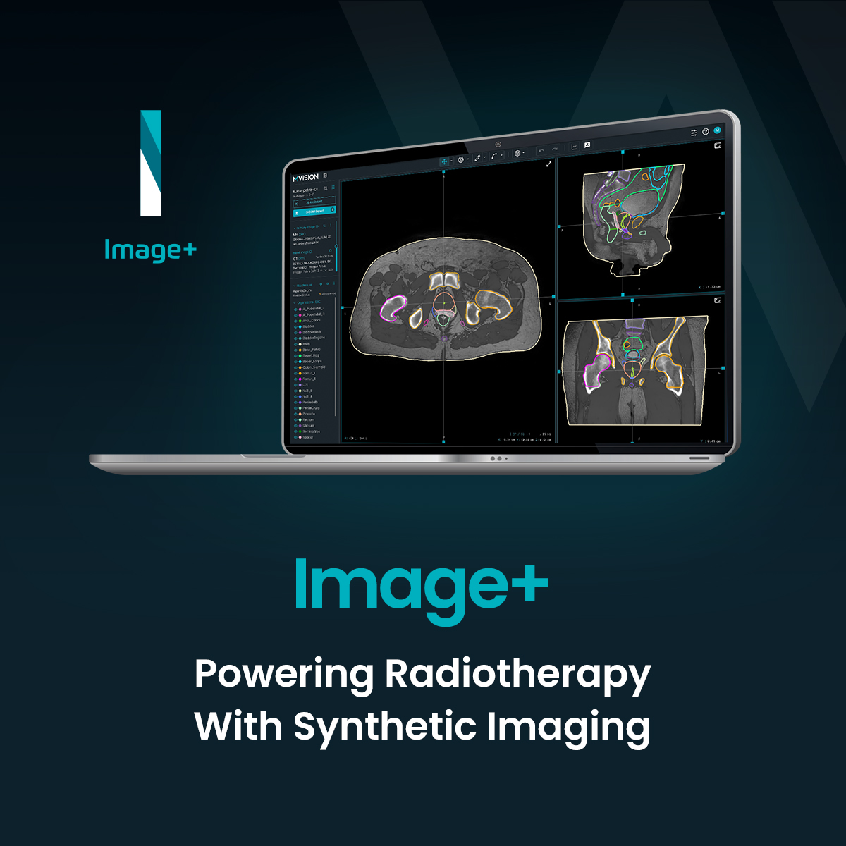 mvisionai's tweet image. Workspace+ unites 4 AI modules that bring automation &amp;amp; consistency to #radiotherapy treatment preparation— helping clinicians reduce manual effort, maintain standardised contours, &amp;amp; strengthen confidence in workflows.

*CE-marked; this product is not available in all markets.