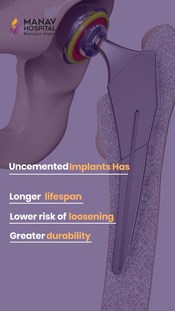 ✅कूल्हे के दर्द का पक्का इलाज🔰Best Hip Implant | Total Hip Replacement Surgery in Hindi
.
.
#hipreplacement #hipreplacementimplants #totalhipreplacement #hippain #jointreplacement #orthopedics #painfree #quickrecovery #shorts 
youtube.com/shorts/AoAaauL…