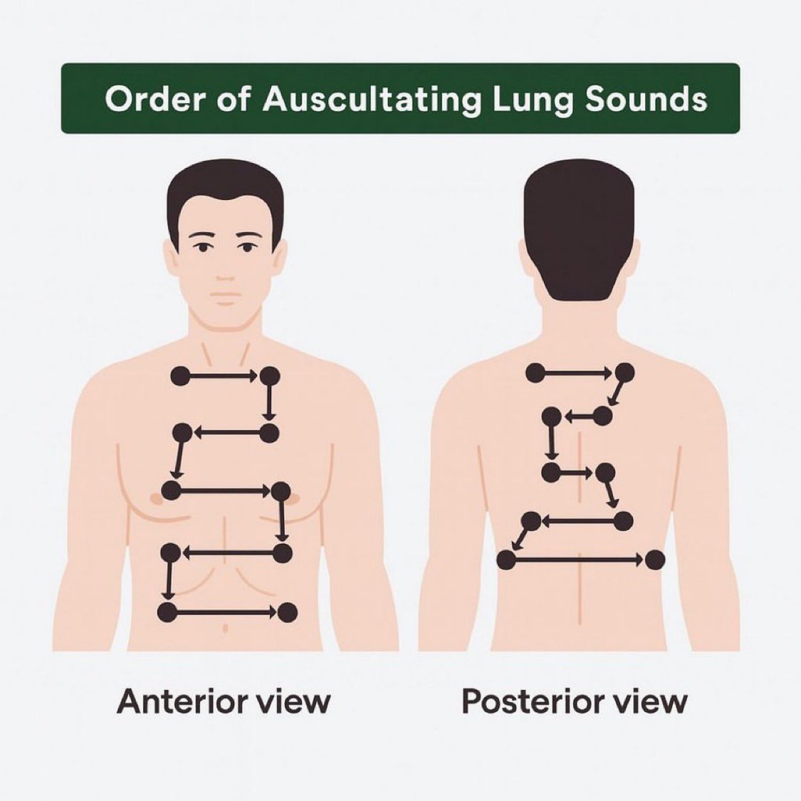The order of auscultating lung sounds is a systematic approach of listening to breath sounds across specific areas of the chest. It involves comparing symmetrical locations on the anterior, lateral, and posterior thorax in a zigzag pattern to assess for abnormalities