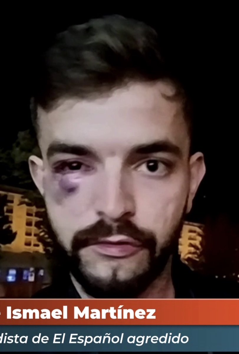 “El principal riesgo es la extrema derecha”.