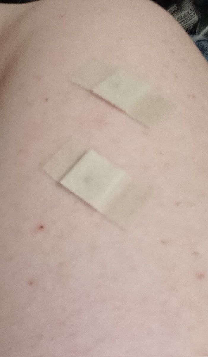 WhisskeyGoddess's tweet photo. 💉💉
Siinä ne ovat vierekkäin sulassa sovussa, #korona ja #influenssa. https://t.co/Nfq90IrBmJ