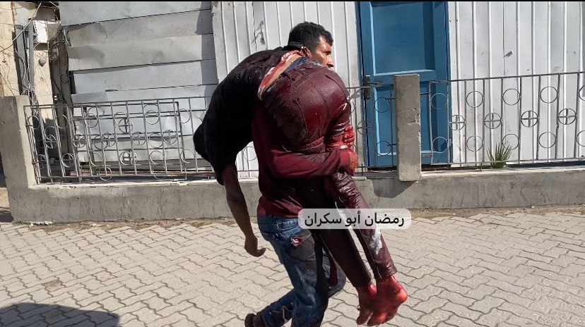 nowgnna's tweet photo. نقل إصابة إلى المستشفى المعمداني جراء القصف المدفعي وإطلاق النار في حي الشجاعية شرق مدينة غزة https://t.co/6qx2D3Lpbz