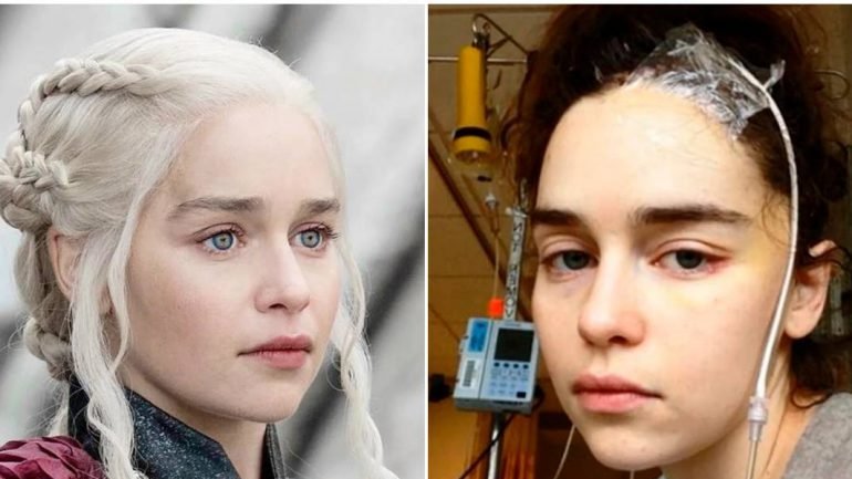 "Si je n’avais pas eu d’hémorragie cérébrale, je serais peut-être devenue une vieille connasse pensant que tout m’est dû en vivant à Hollywood. Je suis tellement plus consciente de ce qui se passe, au moment où cela se produit"

-Emilia Clarke dans son essai publié le 21 mars