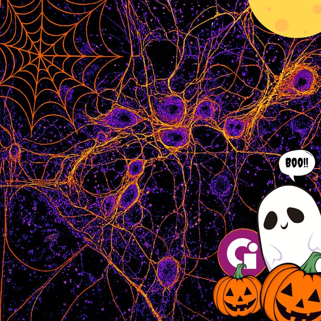 genoainstrument's tweet image. 🎃 Spooky season is on at Genoa Instruments! Happy Halloween from our team 👻
Come to visit us with your samples to acquire terrific ISM images!
Image of neurons entangled forming spiderwebs. 🧠 🕸️ 
#Genoa Instruments #ISM #SuperResolution #SPAD #Neuroscience