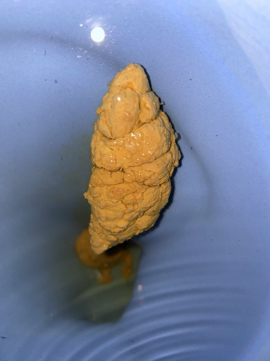 pigscatvzla's tweet photo. El Diamante del día. No es la cantidad, es la pureza y la concentración lo que importa. Una pieza de coleccionista. ¿Quien quiere esta joya?
#scat #scatgay #scatmen #poop #poopgay #poopmem #cagando #hombrecagando #shitting #pooping #eatpoop #eatshit #piggay https://t.co/YtrewPHF0v