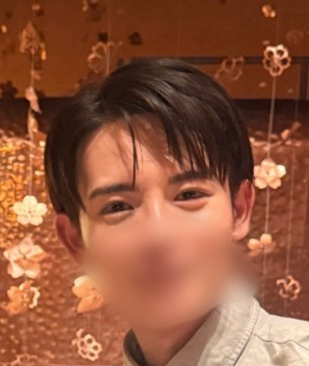 jamjamsaiko___'s tweet photo. DT１ヶ月
涙袋脂肪移植から1ヶ月経ちました
とっても自然で涙袋の膨らみもあって満足です😊
レタッチ込みでもあって1回目を自然にしてくれる先生でめっちゃ信頼できるな！って思いました！(整形は元に戻す引き算が難しいから)
半年後にもレタッチしたいなって思いました！☺️

 #整形  #渡韓整形 https://t.co/hjgAZZOY1H