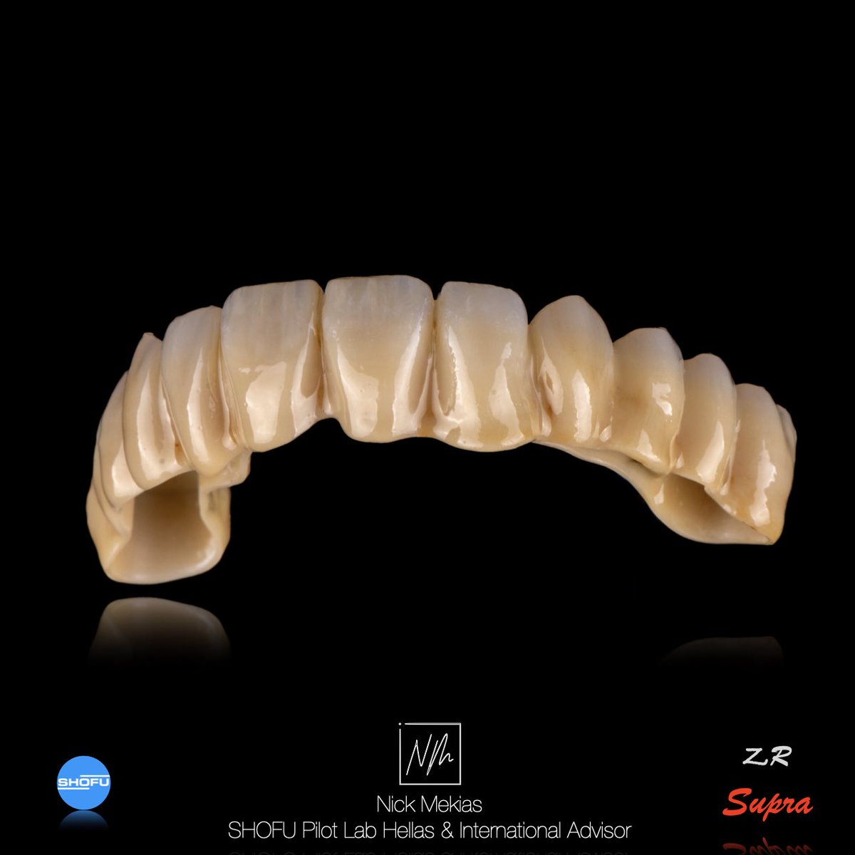 NikosMekias's tweet image. Monolithic posterior segments in SHOFU DISK ZR Supra zirconia, refined micro‑layering on the six anteriors with SHOFU Vintage ZR, and final characterization using SHOFU Vintage Art Universal stains on an anodized titanium bar. #SHOFU #NikosMekias